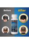 6 Months - Kirkland Generic Minoxidil 5% Hair Loss Treatment for Men - Total 12 Ounces - 5