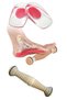 Natural Wooden Foot Massager and Silicone Heel Pad for Heel Spurs (35/40) Foot Roller
