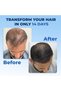 Rosemary Beard & Hair Growth Serum (50ml), Rosemary Extract Serum Hair Spray, Minoxidil 5% S - 7