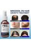 FEGPLUS Minoxidil 5% Hair & Beard Growth Serum – 50ml, Seaweed & Rosemary Extract, Anti Hair Loss - 2