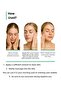 Barrier Strengthening Moisturizing Cream for Acne-Prone, Oily, and Combination Skin - 6