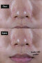 Refreshing and Moisturizing Gel Cream That Reduces Shine for Oily and Normal Skin 50ml - 3