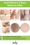 Fast-Acting Skin Whitening and Brightening Cream for Underarms, Bikini Area, and Private Zones - Anti-Darkening Cream - Special Set with Rice Soap as a Gift - 4