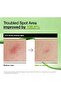 Azelaic Acid 10 Hyaluron Redness Soothing Serum - 6