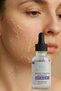 30% Pure Glycolic Acid Serum – Chemical Peel, Anti-Blemish, Pore Tightening - 5
