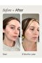 Faded Brightening & Clearing Serum with Kojic Acid & Niacinamide (0.5 Fl Oz) - 3
