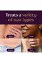 PM Intensive Overnight Scar Cream, Clinically Shown to Make Scars Smaller & Less Visible, 1.0 Oz - 3