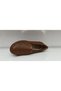 Anatomical Heel Spur Shoe - 3
