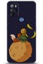 X300 Case Hd Printed Case - a Pair of Eyes 5865