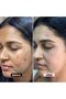 Kojic Acid Cream for Dark Spots & Hyperpigmentation Skin Brightening & Acne Scar Removal 2Pack 50gm - 7