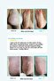 Aloe Soothing Foot Peeling Mask - 6