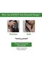 Expert Anti-Dandruff Shampoo | Up to 100% Dandruff Reduction | 750 ML - 4