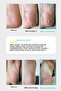 Lemon Extract Foot Peeling Mask - 6