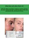 Anti-Acne Moisturizing Cream 50 ml (Azelaic Acid, Zinc Pca, Nad+) - 3