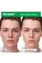 Cicapair Intensive Repair and Soothing Serum Mask 25Gm/.88Oz - 3