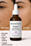 Kojic Acid + Turmeric Extract Anti-Blemish Serum |   Skin Tone Equalizer
