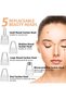 Blackhead Remover Vacuum, Electric Pore Vacuum Cleaner Heads Removal Deep Clean Facial Kit For Women - 4
