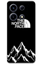 Infinix Note 30 Vip Case Hd Pattern B Printed Back Cover - the North