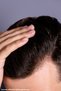 Anti-Dandruff Shampoo for Dandruff-Prone Hair with Menthol Keratin Effective Against Dandruff Professional Shampoo 1 Lt - 4