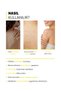 XL Face and Body Acne Patch - 5