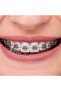 Advanced Series Roth Steel Bracket 0.022 - 5