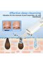 Skin Scrubber Ultrasonic Blackhead Remover for Face, 4 Modes, Pore Cleaner - 3