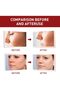Mole Removal Essential Oil - Skin Tag & Mole Remover with Herbal Extracts, 20 ml - 4