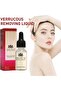 Mole Removal Essential Oil - Skin Tag & Mole Remover with Herbal Extracts, 20 ml - 8