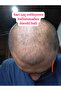 Sarı Saç Solusyonu - 7