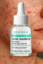Nokta Serum – 2% Salicylic Acid + 1% Zinc Pca, Acne Treatment with Fast Drying Effect - 4