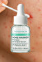 Nokta Serum – 2% Salicylic Acid + 1% Zinc Pca, Acne Treatment with Fast Drying Effect - 3