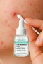 Nokta Serum – 2% Salicylic Acid + 1% Zinc Pca, Acne Treatment with Fast Drying Effect - 2