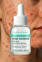 Nokta Serum – 2% Salicylic Acid + 1% Zinc Pca, Acne Treatment with Fast Drying Effect - 5