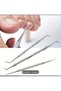 Changsha 3-Piece Stainless Steel Ingrown Toenail Tool Set - Professional Surgical Safe Nail Care - 7