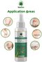 Hair Reducing Depilatory Slimming Saad Oil (Cyperus Rotundus Oil) 75 ml ((3 Pieces) - 3