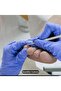 Changsha 3-Piece Stainless Steel Ingrown Toenail Tool Set - Professional Surgical Safe Nail Care - 8