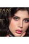 عدسات يومية سكاي #13 - 2