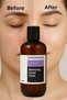 Chamomile Extract Skin Balancing Tonic |   Anti-Redness – Pore Tightening – Skin Soothing - 2