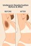 30% Lactic Acid Peeling – Powerful Aha Exfoliation |   Face, Underarm and Bikini Area Tone Lightener - 4