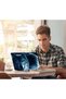 ALAYRA Laptop Skin Sticker Decal Covers 12" 13" 13.3" 14" 15" 15.4" 15.6 inch Laptop Skin Sticker - 2