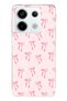 Redmi Note 13 Pro 5g Compatible Soft Pink Bow Patterned Printed Silicone Case
