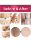 Anti-Darkening Skin Whitening Cream - 5