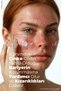 Anti-Rash, Redness and Irritation Soothing Repairing Care Cream – Anti-Rash Cream 100 ml - 3