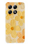 Xiaomi Mi 14t Pro Compatible Touch of Sunshine Yellow Daisy Printed Silicone Case