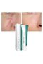 Acne Removal Face Cream Skin Repair Care Remove Stretch Marks Whitening Cream (30g) - 4