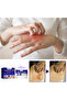 Anti-Bacterial Cream – Fast Relief for Skin Infections, Itching, Rashes & Irritation - 6