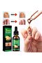 Nail Fungus Treatment Serum | Fast-Acting Formula for Healthy Nails - 3