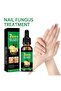 Nail Fungus Treatment Serum | Fast-Acting Formula for Healthy Nails - 7