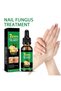 Nail Fungus Treatment Serum 7 Days Care Formula for Toenail & Fingernail Repair - 4