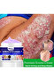 Anti-Bacterial Cream – Fast Relief for Skin Infections, Itching, Rashes & Irritation - 3